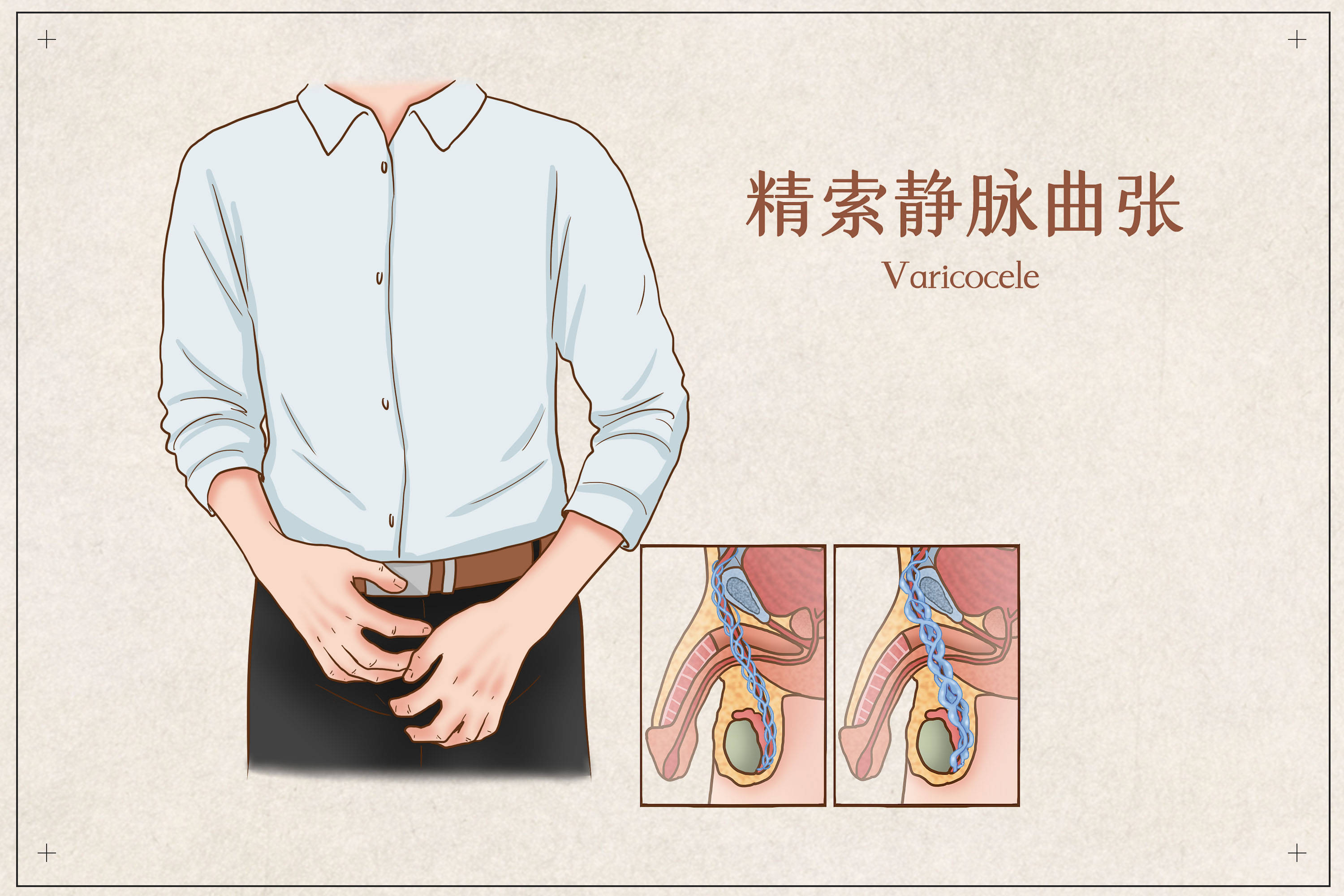 蛋疼挂什么科-(睾丸一个疼一个不疼)