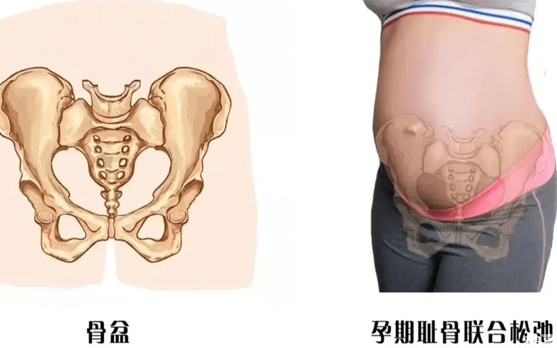 骨盆内测量_(骨盆内测量视频教程)