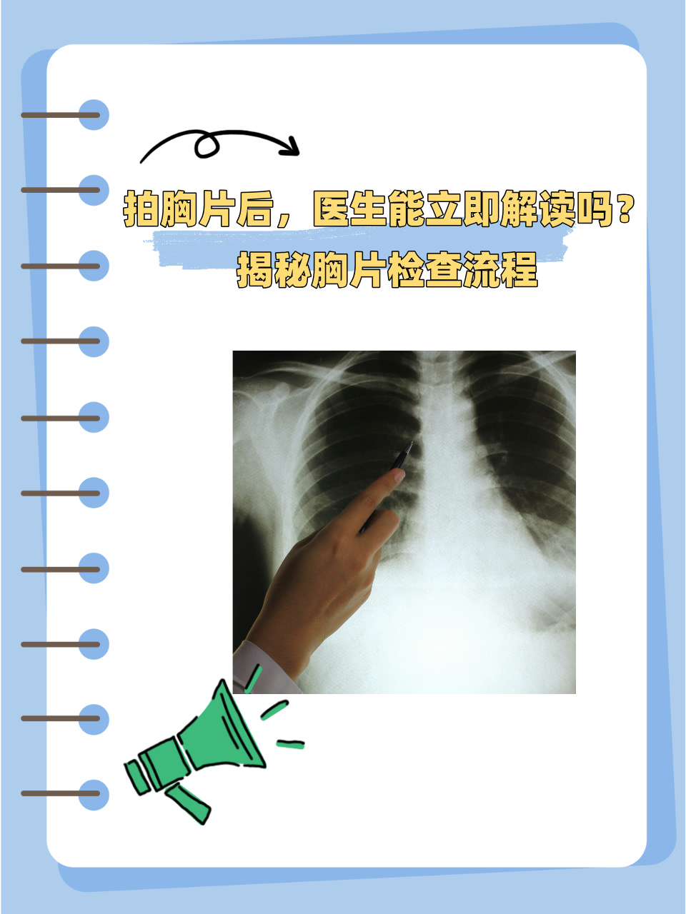 胸片挂什么科_(拍个胸片挂什么科)