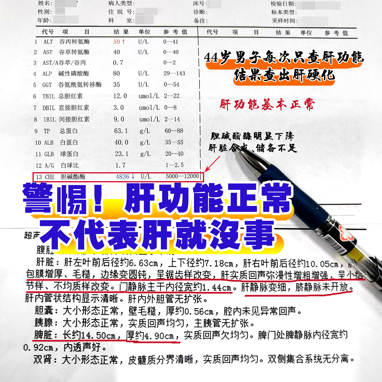 乙肝怎么查-(乙肝怎么查出来)