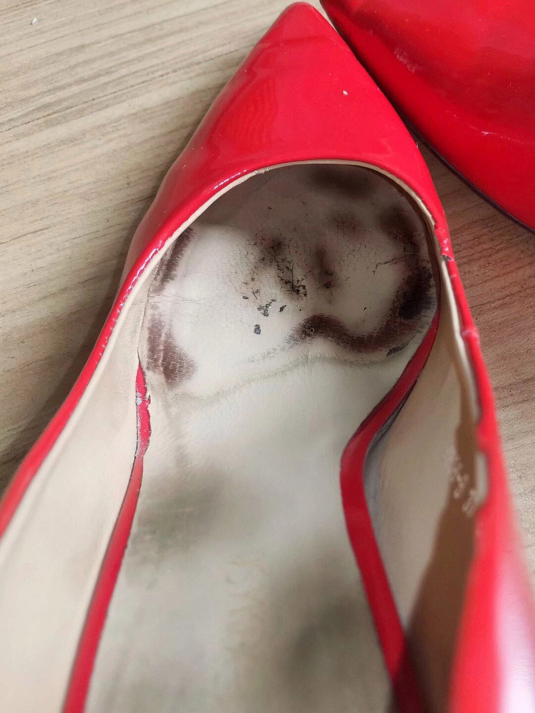 女朋友脚臭(女朋友脚臭怎么办)