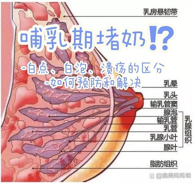 乳头硬(乳头硬了是什么原因引起的)