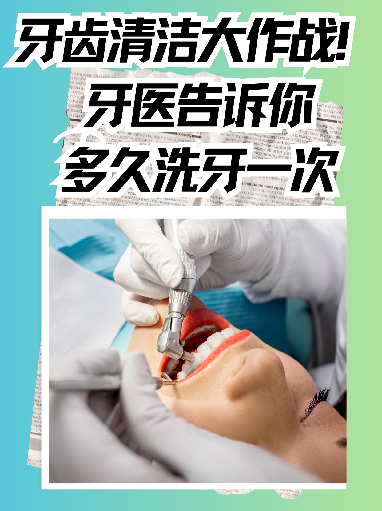 洗牙一般要多久-(洗牙一般要多久恢复正常)