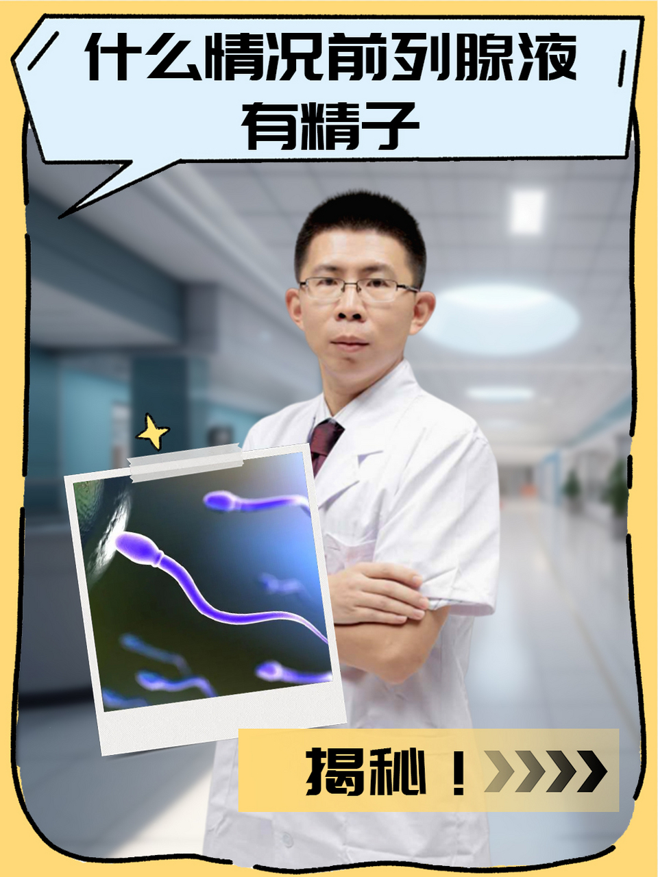 取前列腺液(取前列腺液尴尬吗)