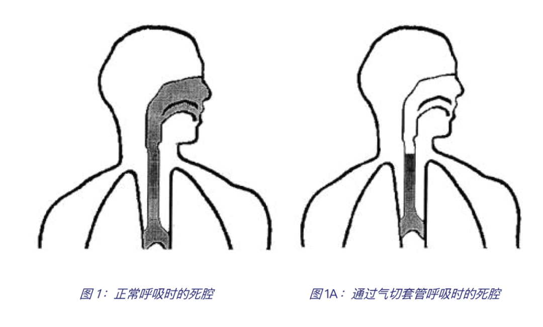 死腔样通气_(死腔样通气可见于)