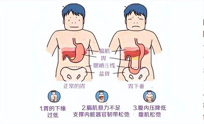 胃在左侧还是右侧-(胃在左侧还是右侧啊)