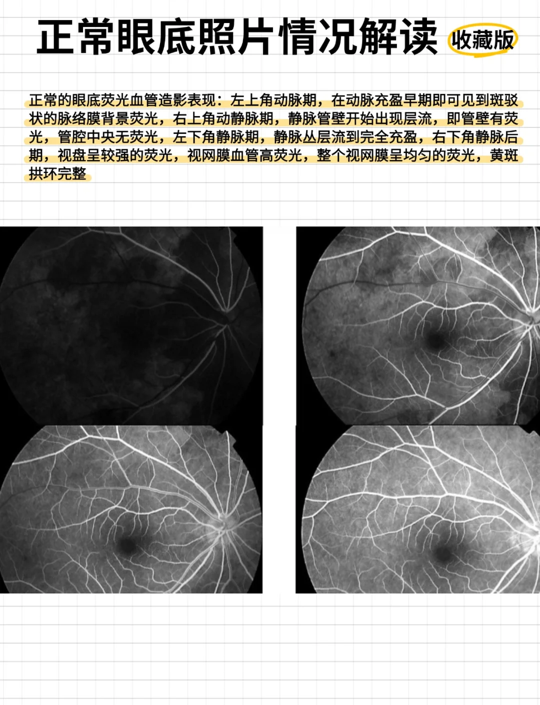 视神经盘名词解释(视神经盘视神经乳头名词解释)