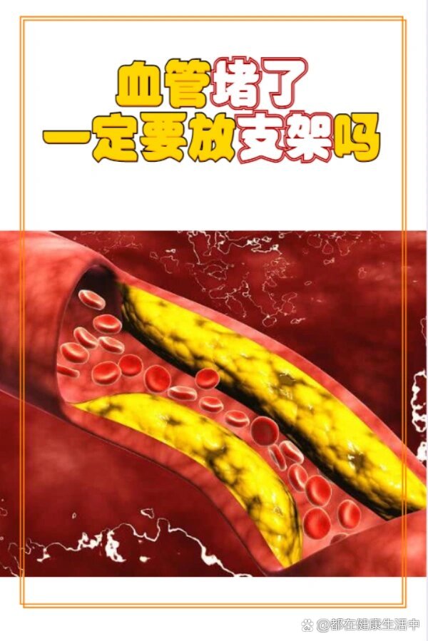 血管是器官吗_(血管是器官吗还是组织)