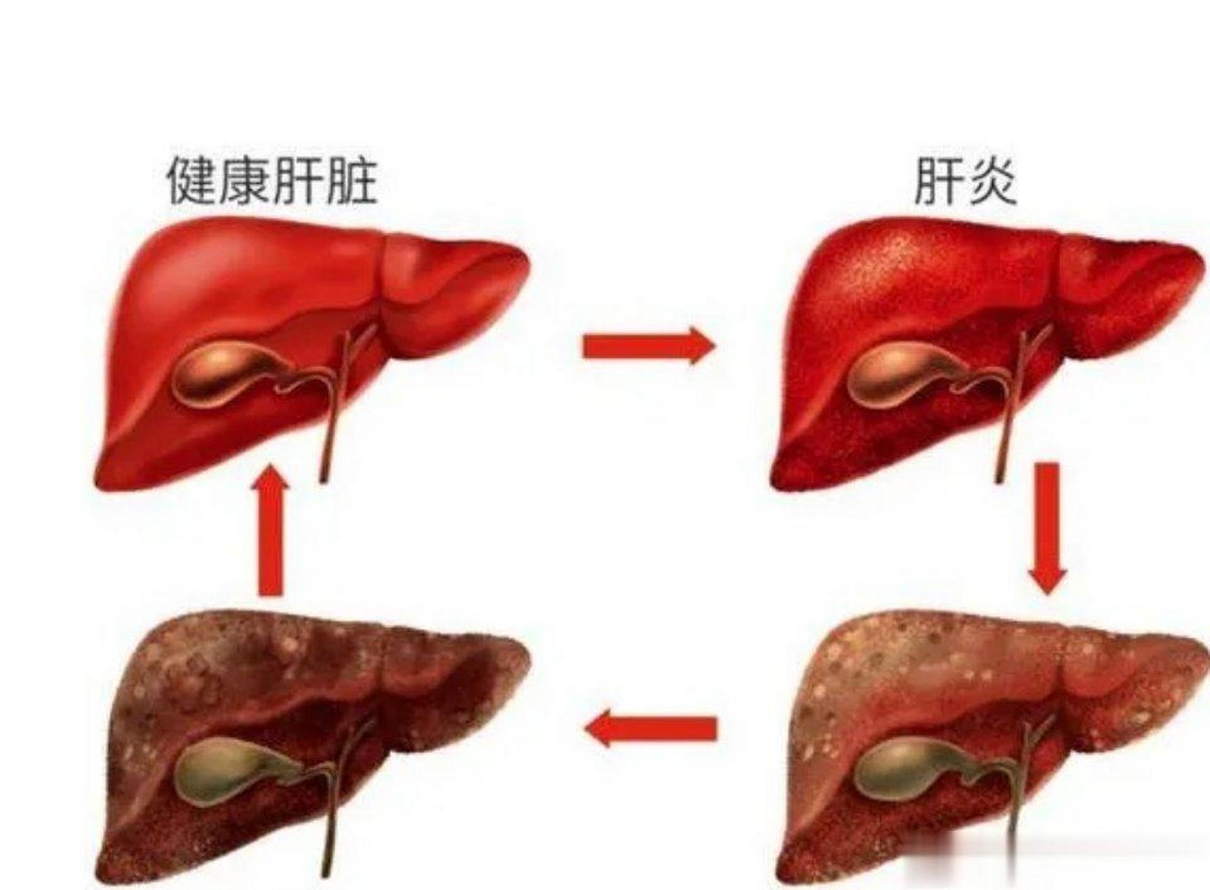 血滞通(血滞通治什么病最好)