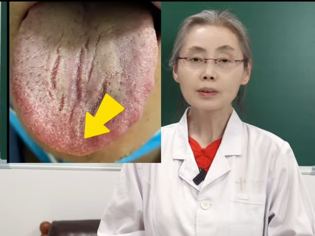 舌头发黑是什么病_(人的舌头发黑是什么病)