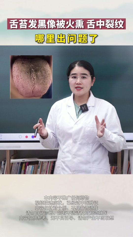 舌头发黑是什么病_(人的舌头发黑是什么病)