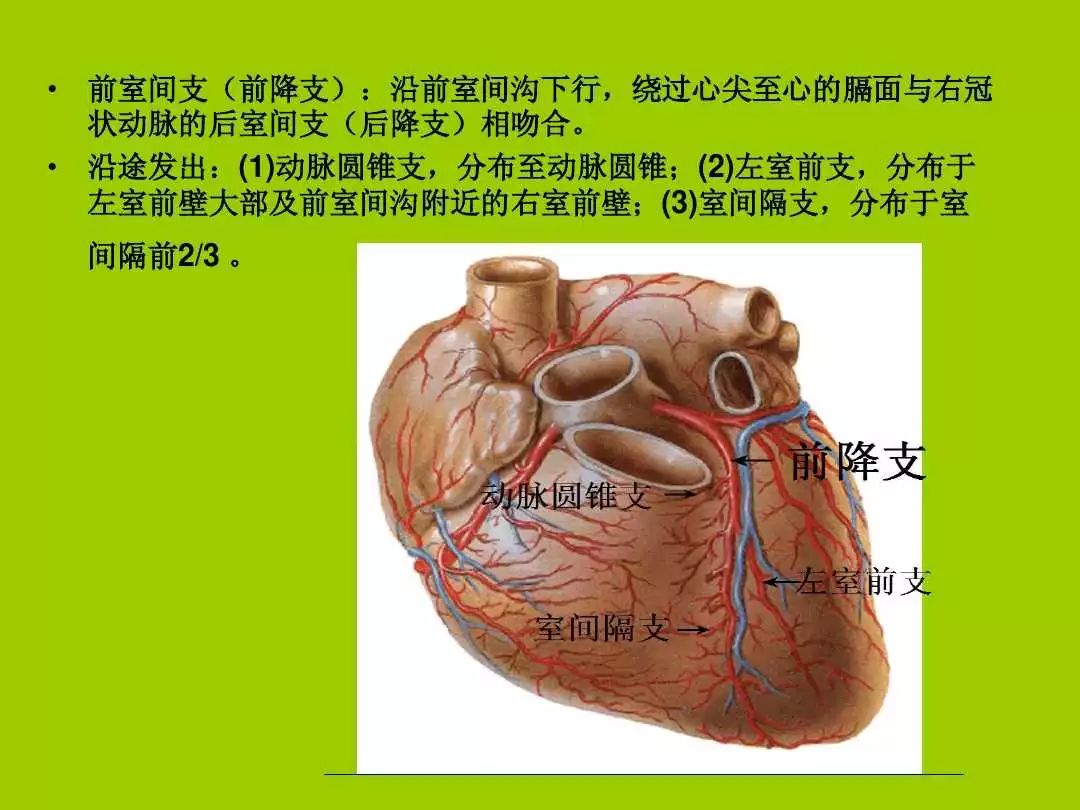 左冠状动脉前降支(左冠状动脉前降支近段钙化斑块)