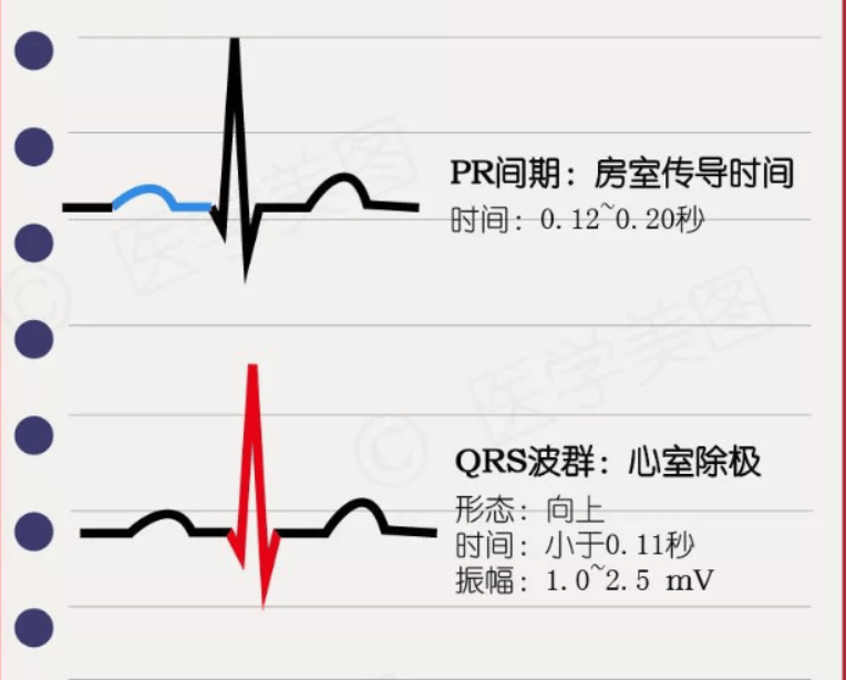 心电图pr间期-(心电图pr间期代表什么)
