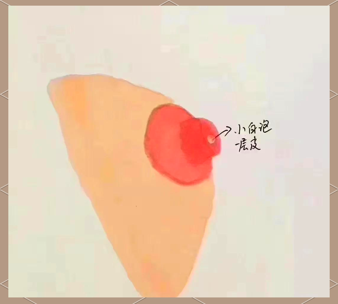 女生乳头小-(女生乳头小是什么原因引起的)