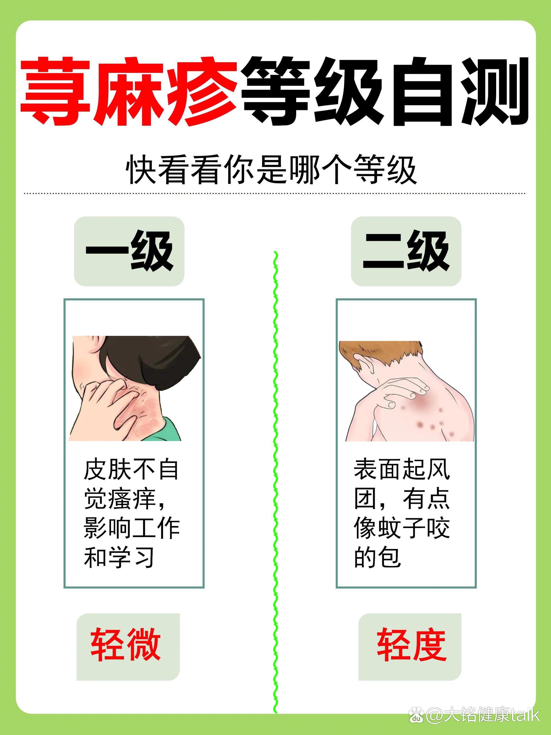 荨麻疹种类(荨麻疹种类辨别图片)