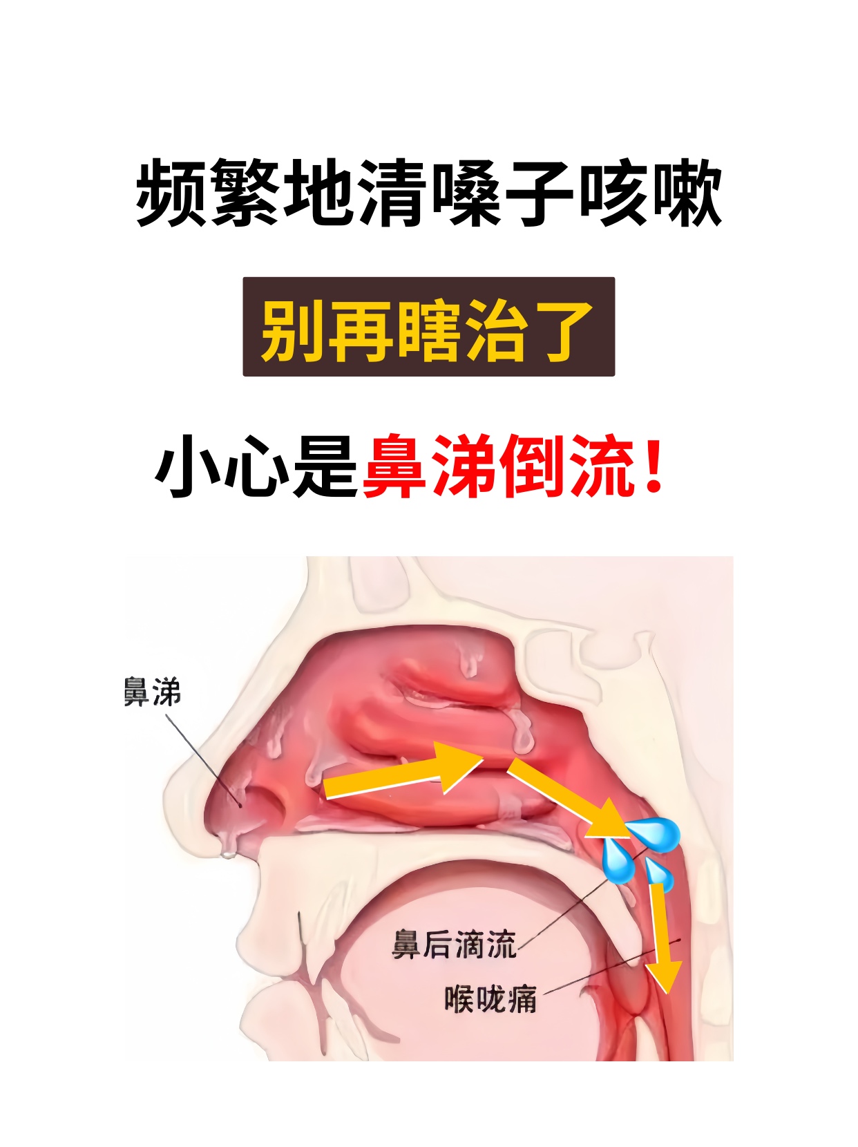 流鼻涕挂什么科-(打喷嚏流鼻涕挂什么科)