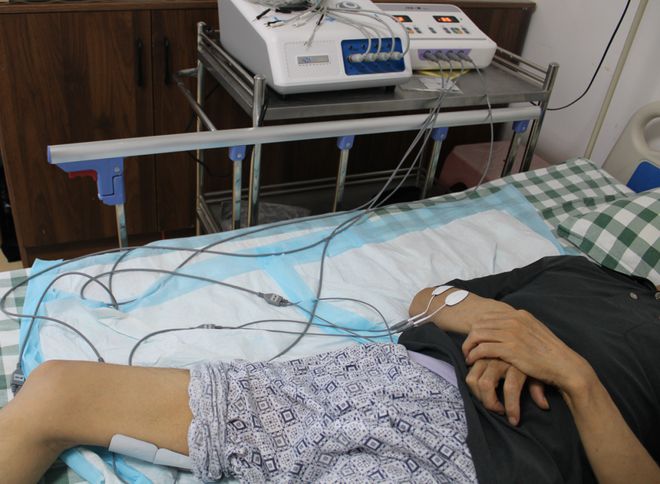 脑梗死的治疗(脑梗死的治疗原则)