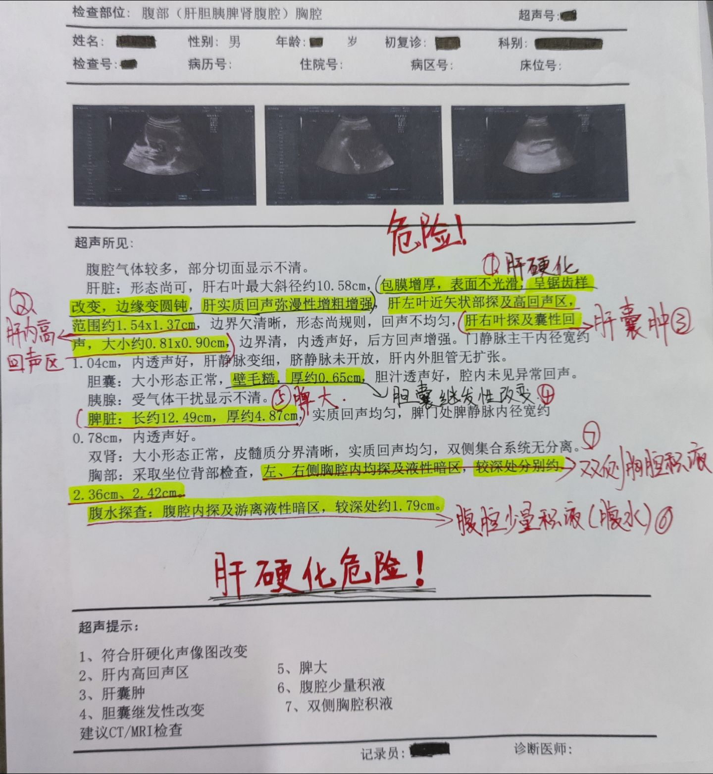 肝脏弥漫性改变(肝脏弥漫性改变吃什么药)