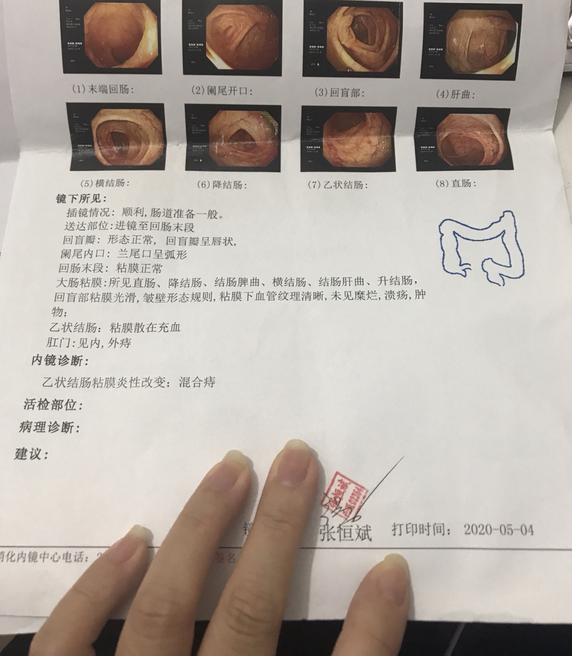 慢性胃炎多久能好_(严重的慢性胃炎多久能好)