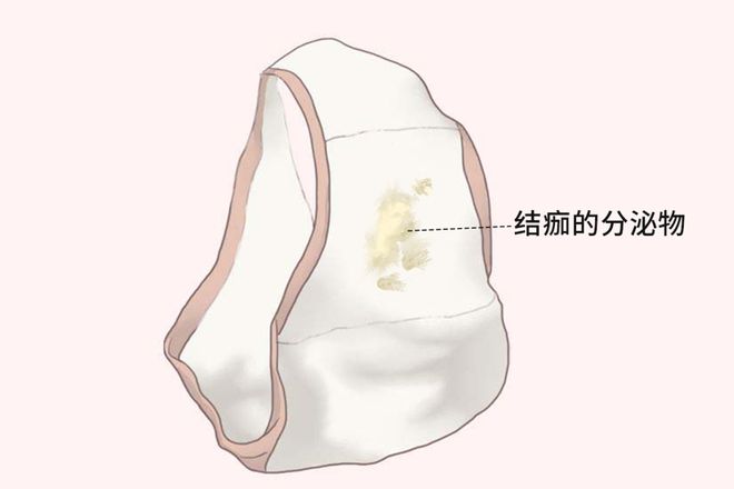 处女膜是白色的吗-(是处和不是处的区别图)