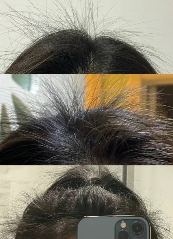 生发最好的方法-(防脱生发最好的方法)