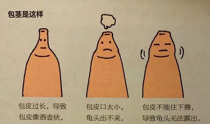 小孩包皮_(小孩包皮图片真实照片)