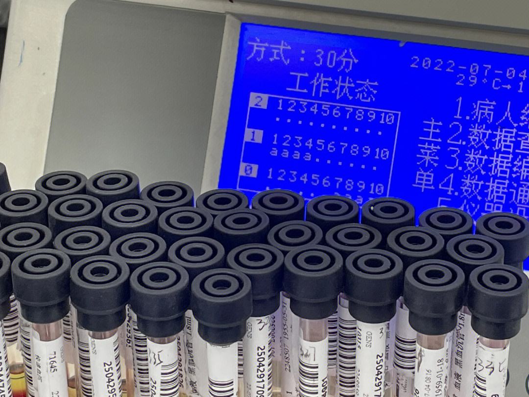 潜血试验(潜血试验前三天患者应禁食)