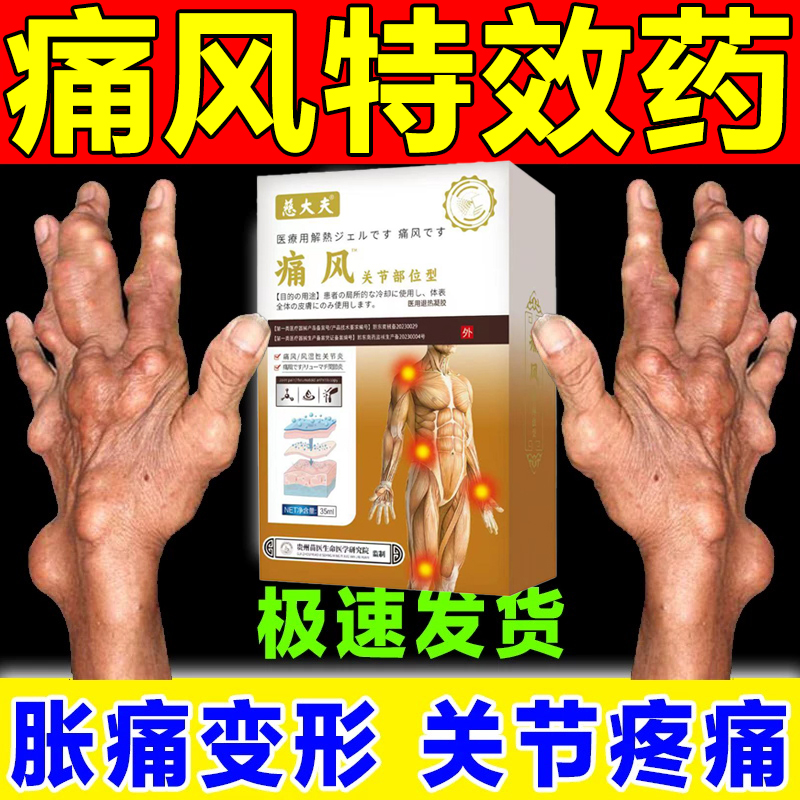 风湿病吃什么药-(内风湿病用什么药最好)