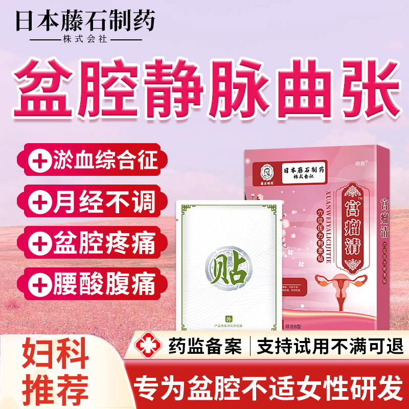 盆腔静脉曲张(盆腔静脉曲张影响怀孕吗)