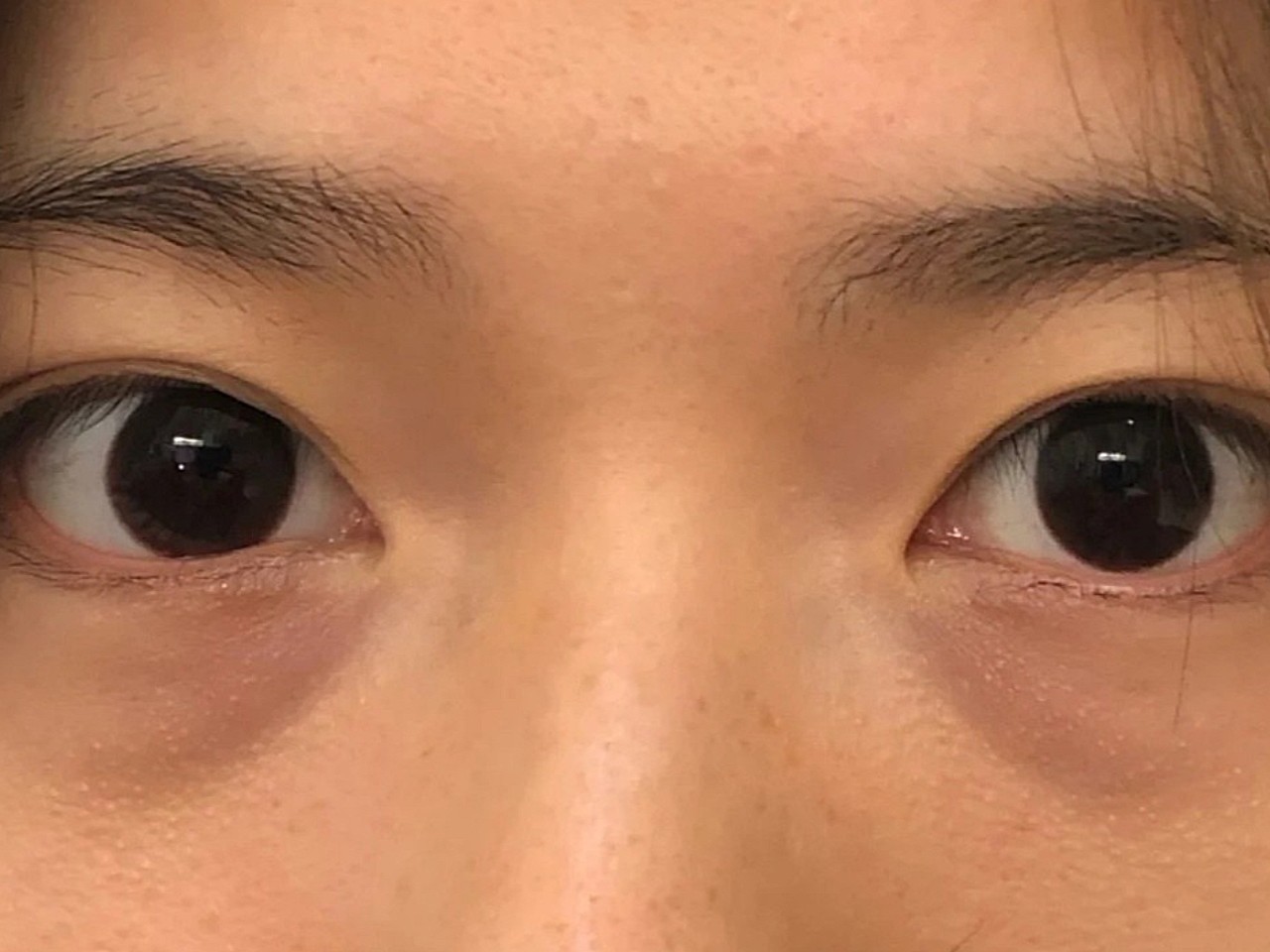 泪河高度_(泪河高度正常值)