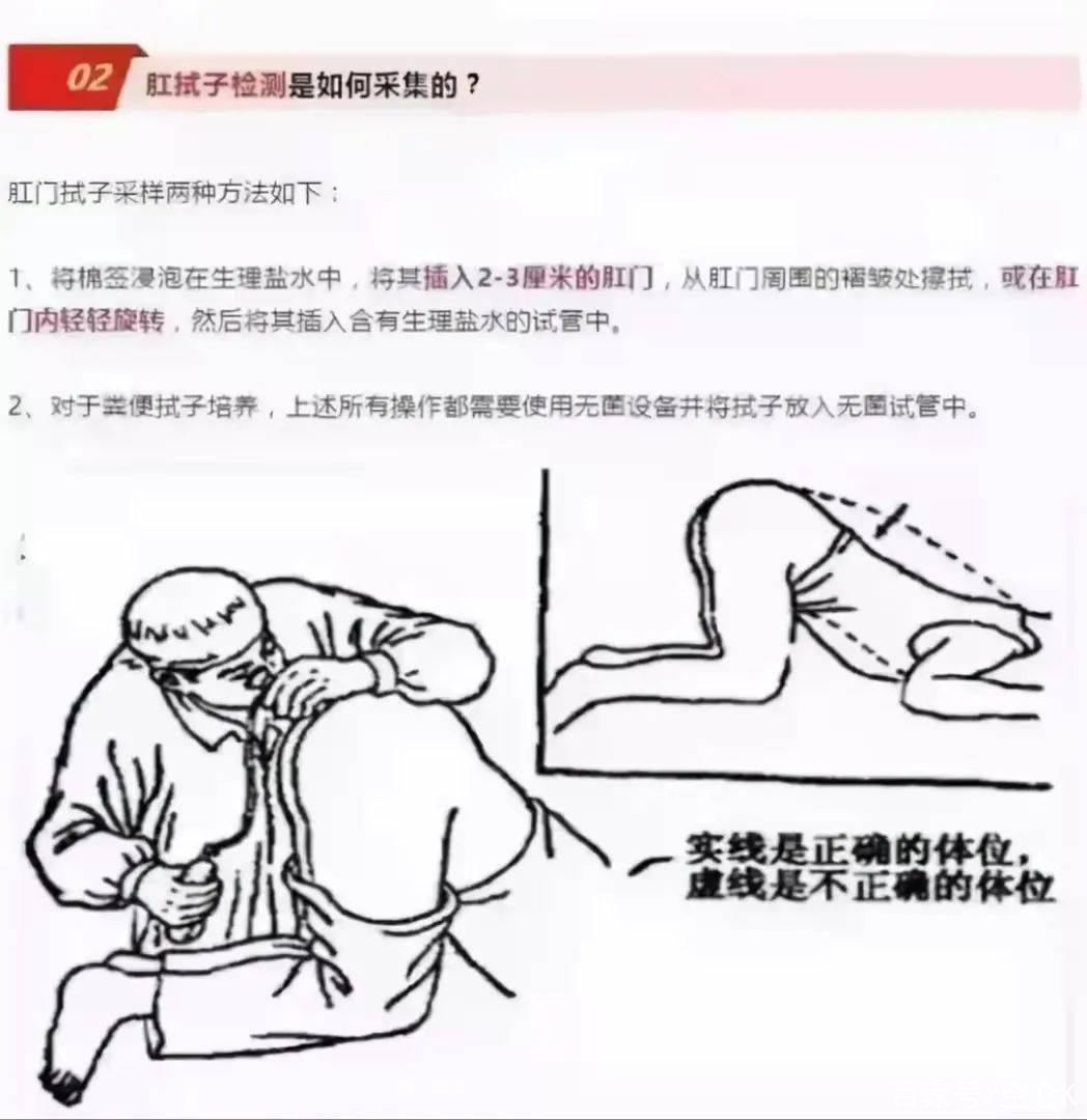 亲屁眼(深圳女子肛门剧痛告上法庭)