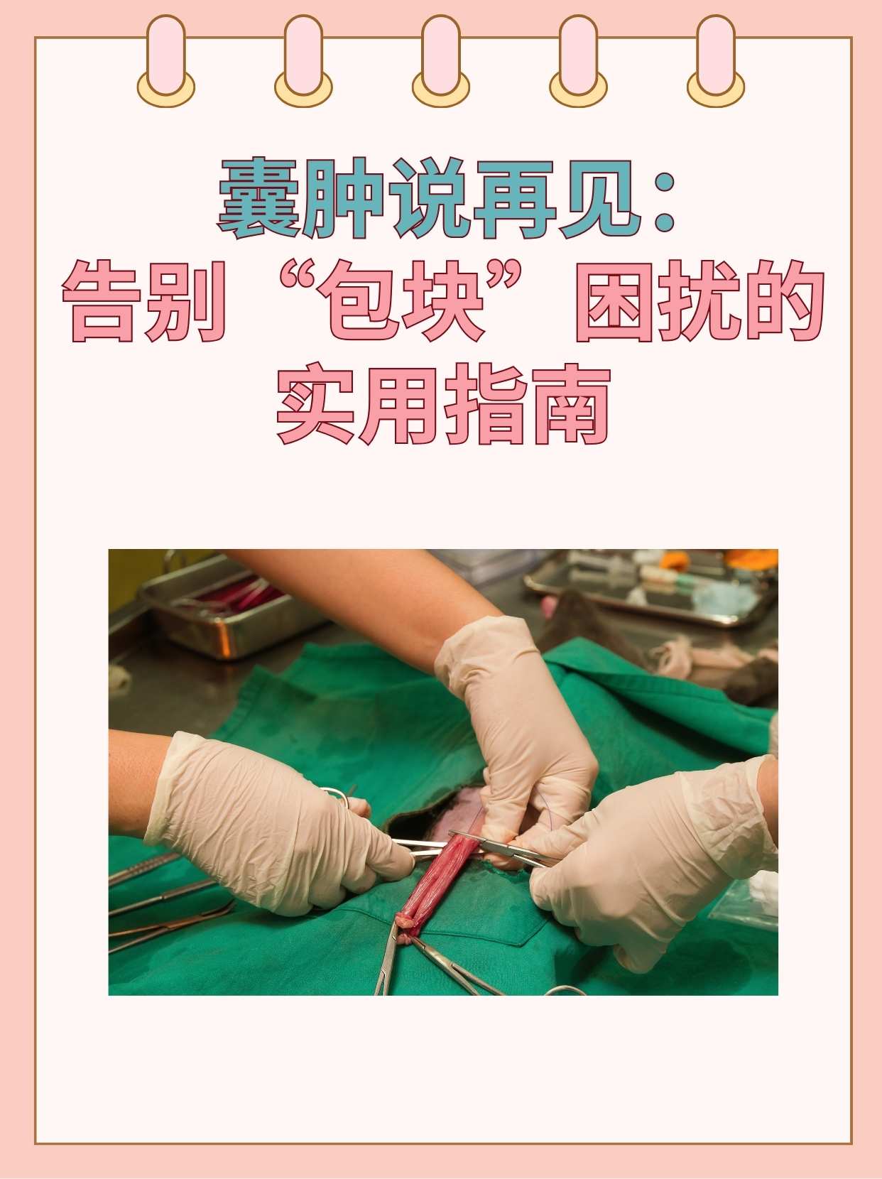 囊肿如何治疗(宫颈囊肿如何治疗)