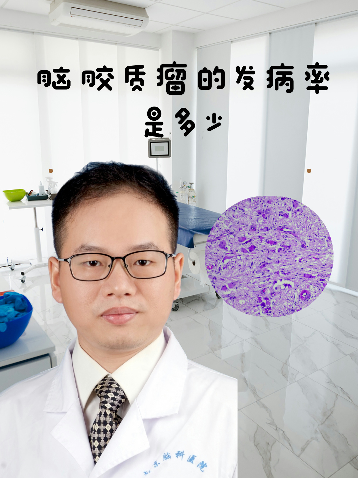什么是胶质性脑瘤-(什么是胶质性脑瘤 早期10岁动手术治疗)